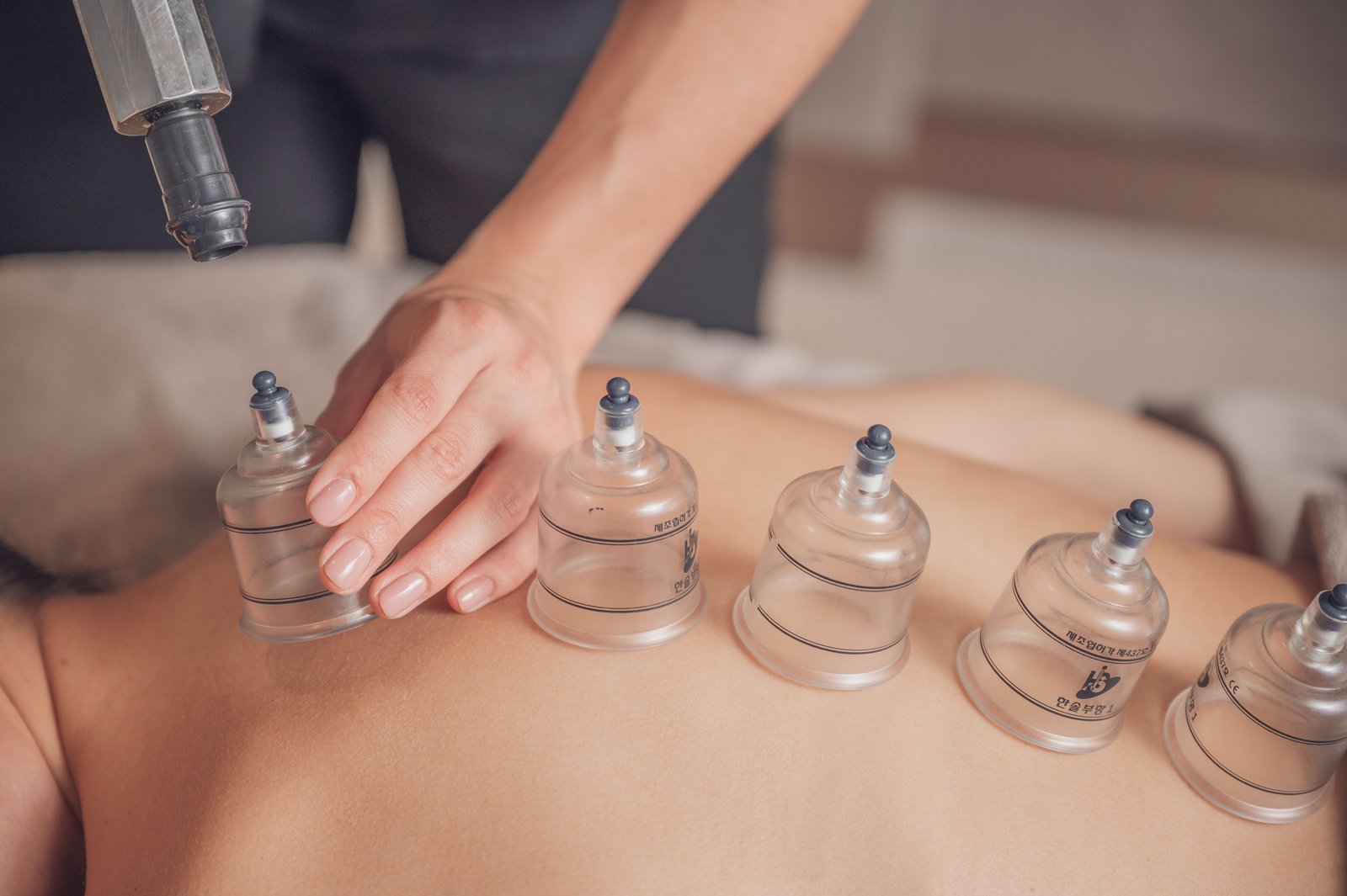 Myofascial cupping treatment